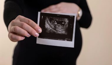 Can the placenta predict schizophrenia risk? Lessons from prenatal cannabis exposure