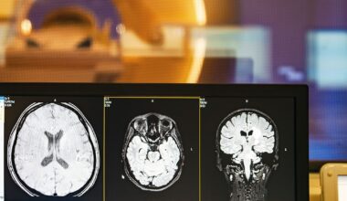 Gut microbiome may drive memory loss via vagus nerve