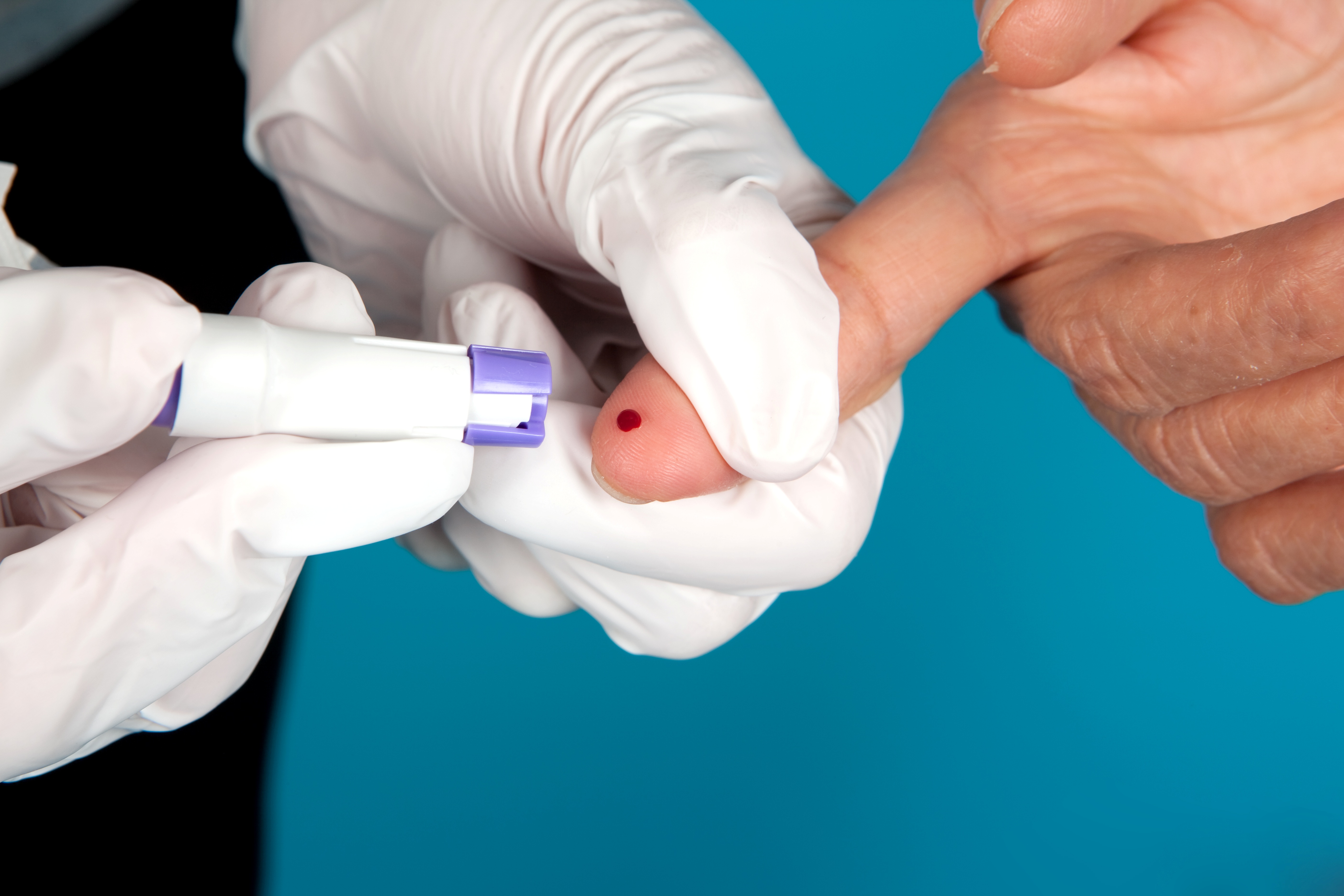 Blood sample being taken