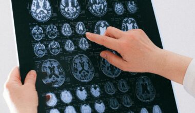 The Brain Beneath the Label