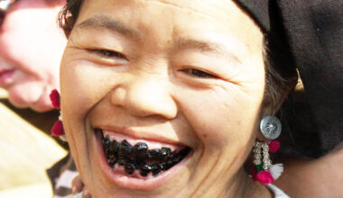 Tooth blackening beauty trend in Vietnam began 2,000 years ago