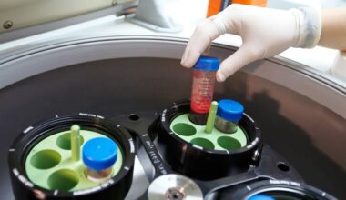 What is UK Biobank? Medical database that’s a victim of own success