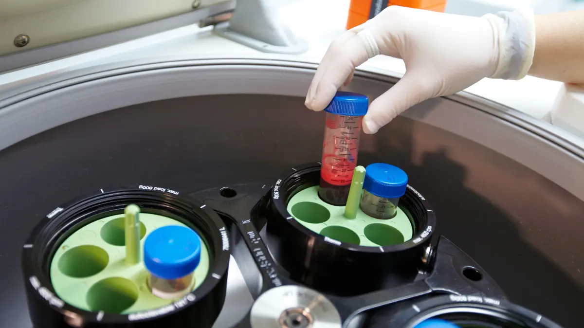 What is UK Biobank? Medical database that’s a victim of own success