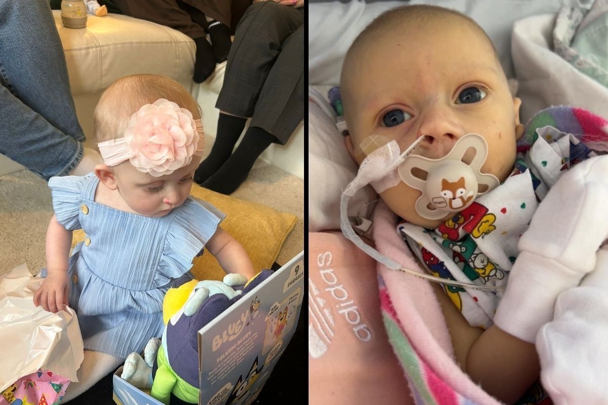 Aurora Oliver, celebrating her birthday, left, and right when she was in hospital as a newborn