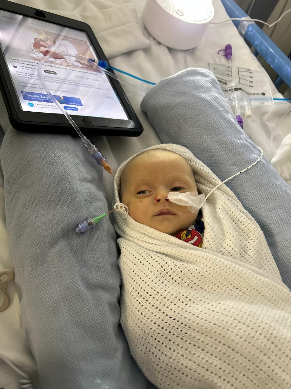 The little girl needed surgery called the Kasai procedure when she was just a few weeks old