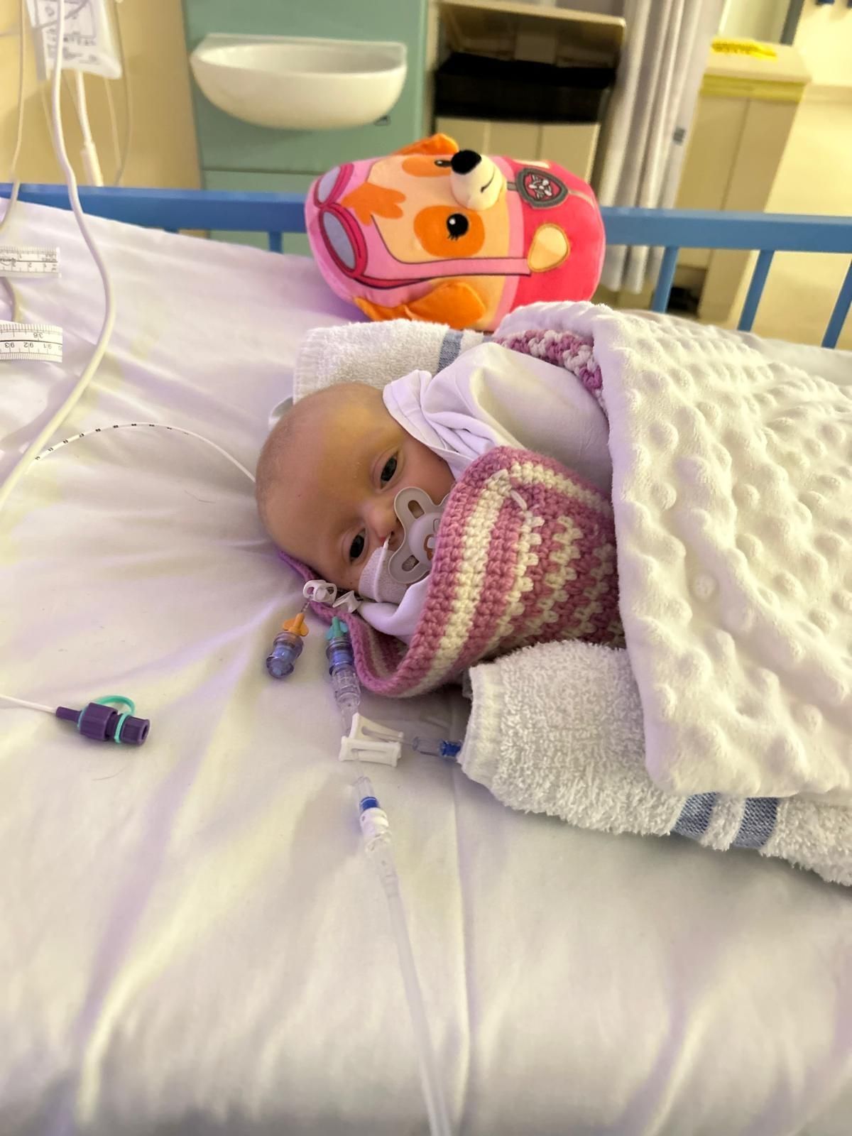 Aurora was diagnosed with biliary atresia just weeks after birth