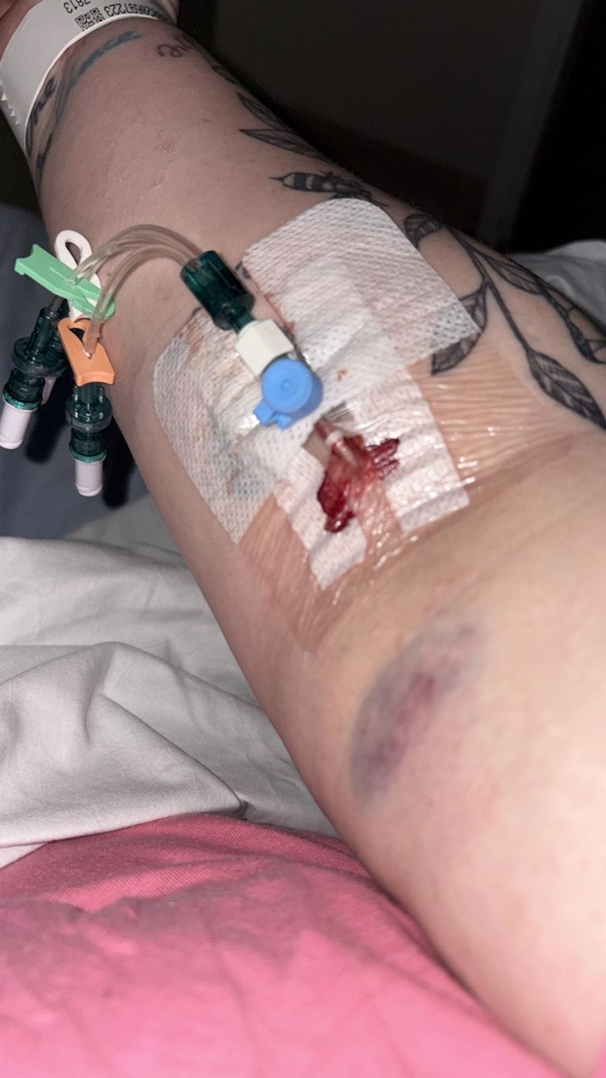 Kailtyn Spearman is currently in hospital in South Tyneside