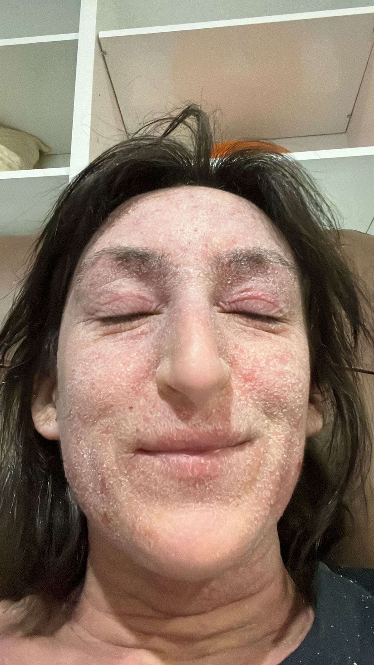 Rosemary showing her dry face