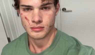 Clavicular has revealed that he is home after being rushed to the hospital following a suspected overdose amid an unsettling livestream that suddenly ended on Tuesday night