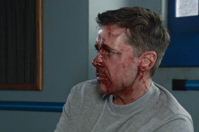 15_04_coro_todd_police_01 A badly beaten and bloody Todd sits in the police interview room in Coronation Street