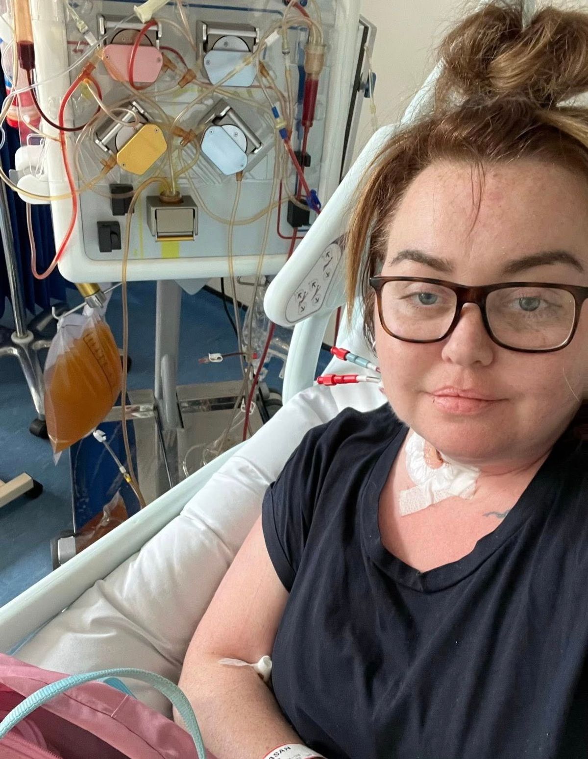 Josie Thompson in hospital after a mole turned out to be cancerous