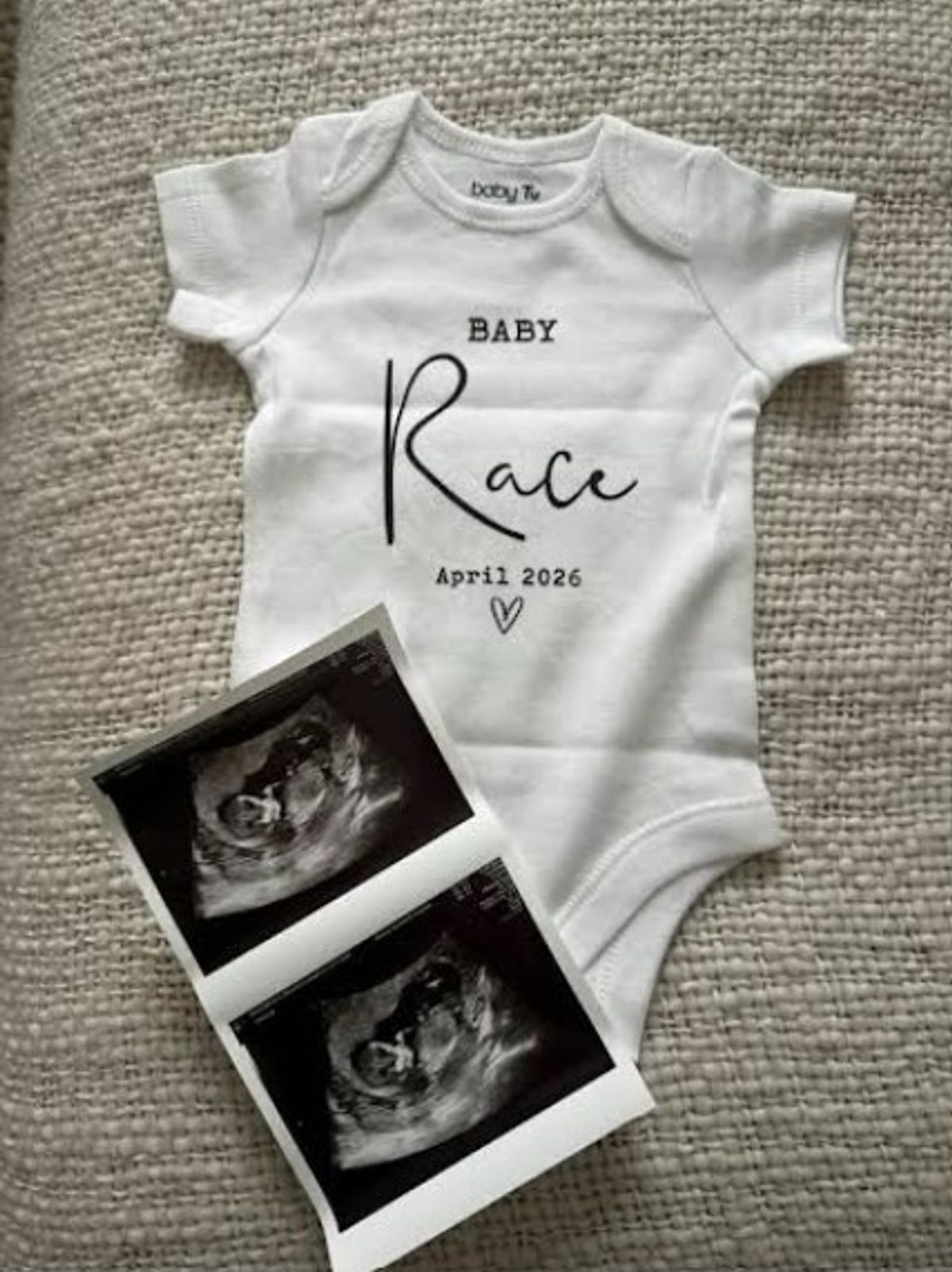 Luca's scan photo
