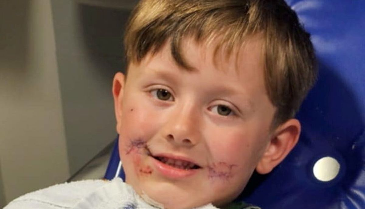 A picture of Antonio with scars on his face