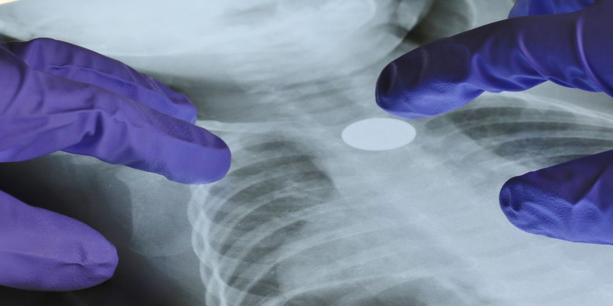 Cancer diagnosis rates soar as NHS faces worst waiting times on record