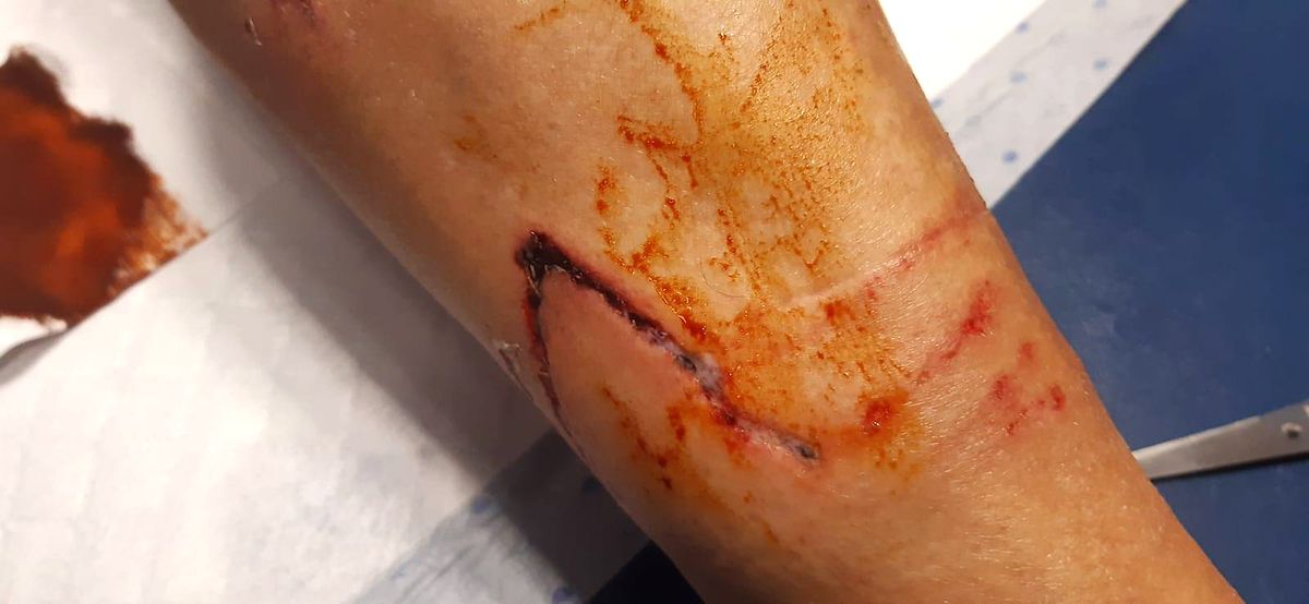 Leon's legs were left covered in blood