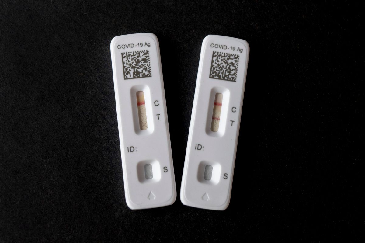 A positive and negative Covid-19 home test on a black background. (Photo by: Michael Siluk/UCG/Universal Images Group via Getty Images)