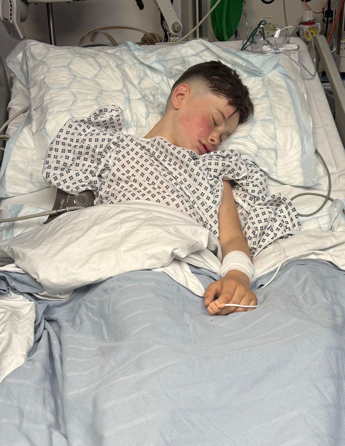 James asleep in a hospital bed