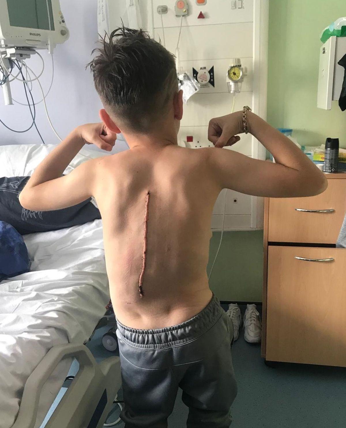 James with a scar running down his back