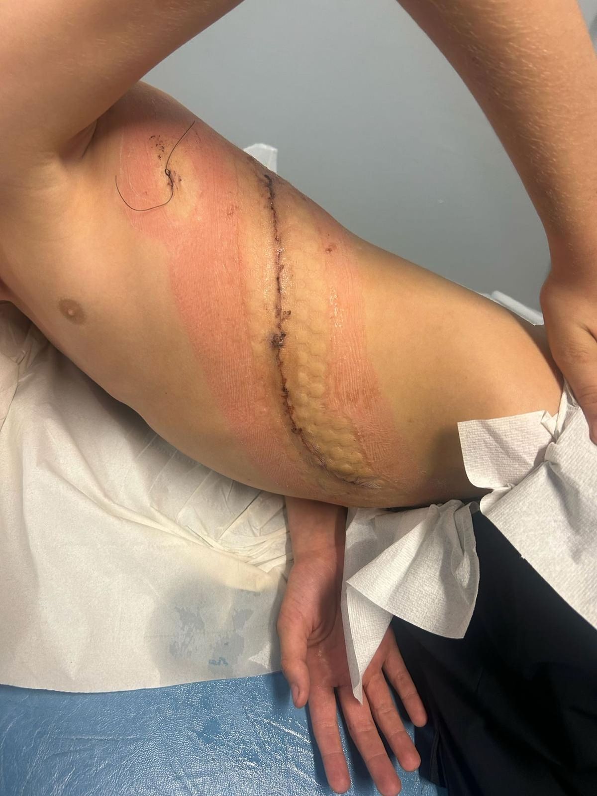 James with a twisted scar across his torso