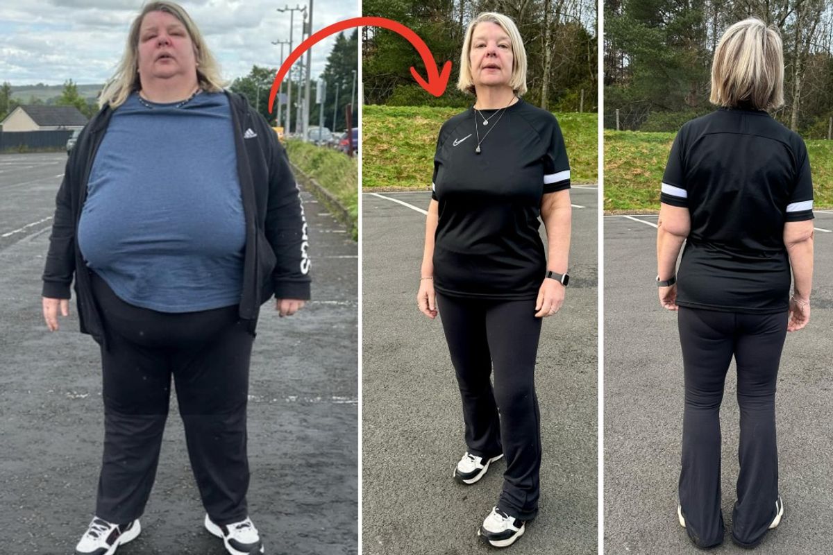 Before and after of Karen after using the Simple app, with the before showing her bigger and the after showing a dramatic weight loss
