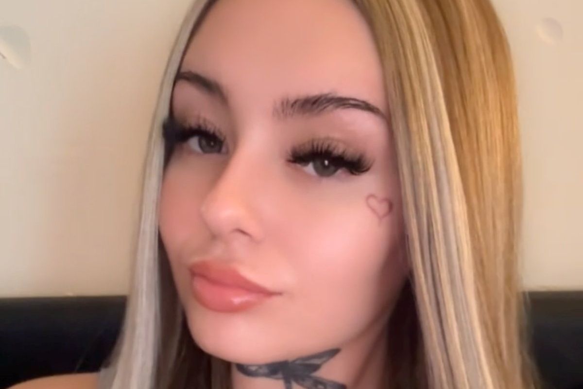 Kayley is hoping to fund private treatment