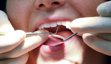 Scottish Greens propose scrapping NHS dental charges