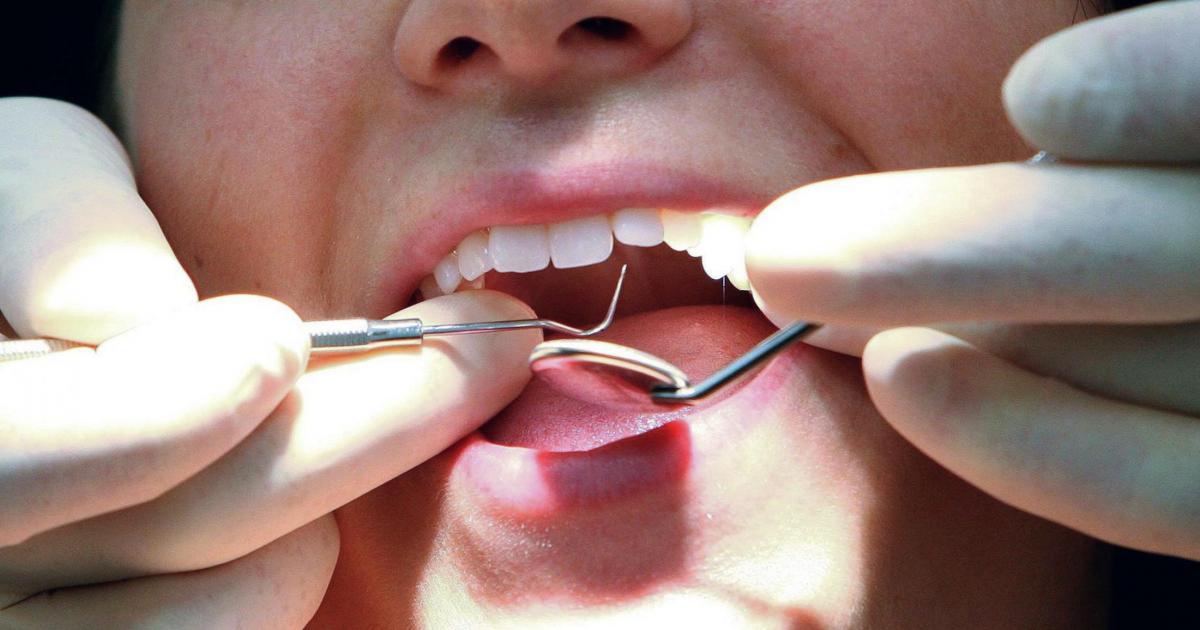 Scottish Greens propose scrapping NHS dental charges