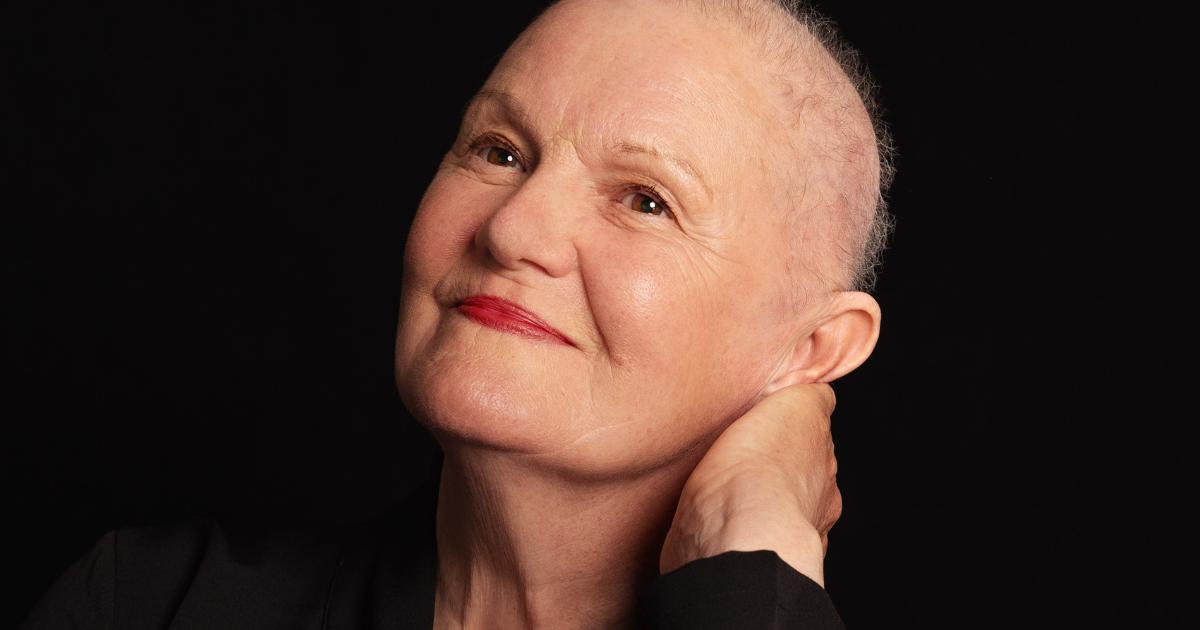 Breast cancer photography exhibition to open in Edinburgh