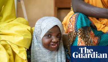 ‘Astonishing’ discovery could help save children from deadly disfiguring condition | Global development