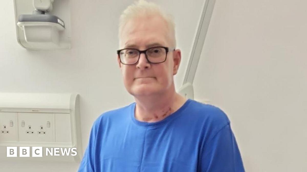 Darren White, 53, from Stockton-on-Tees, who is one of the first lung transplant patients in the UK to have a patch of their organ donors skin grafted onto their forearm in the hope that it could help medics spot signs of the lung being rejected by the body sooner.
