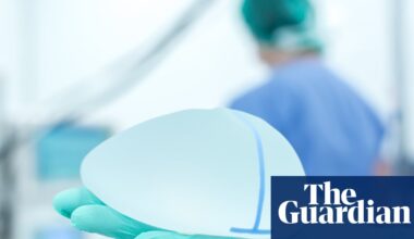 Breast reductions in UK overtake enlargements for first time, data shows | Plastic surgery