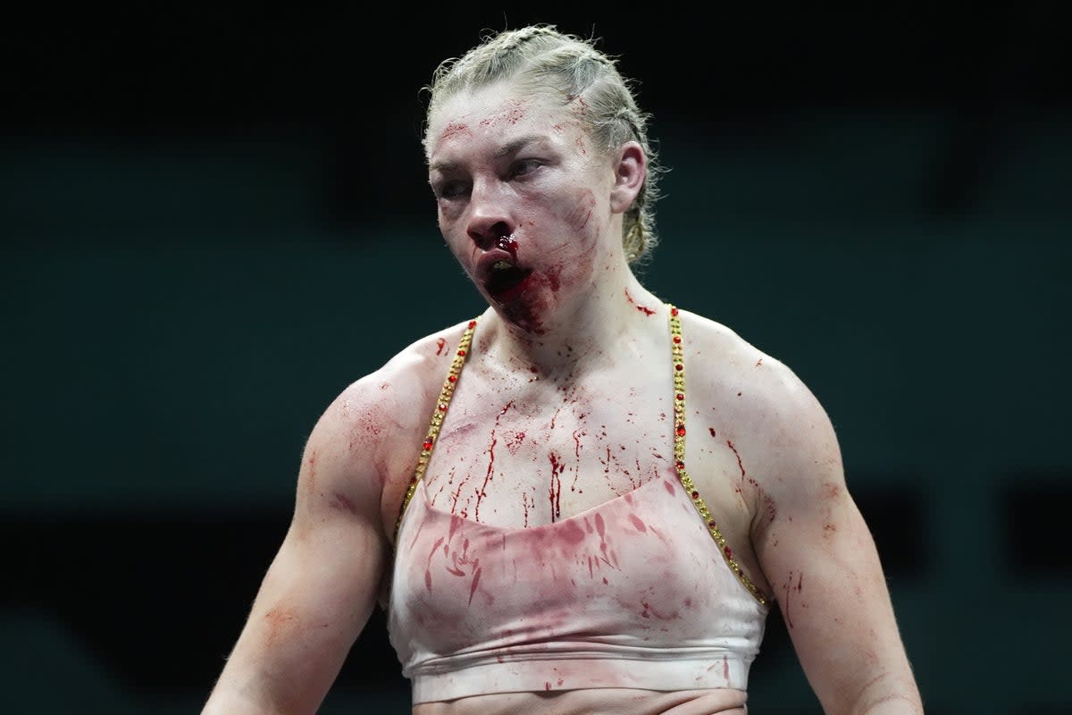 Lauren Price suffered a mouth injury during her victory (Nick Potts/PA) (PA Wire)