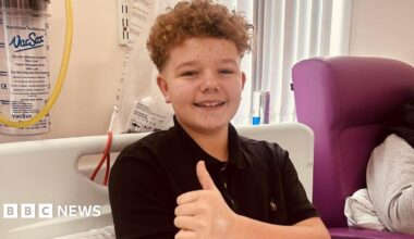 A boy in a hospital bed with curly ginger hair, wearing a black polo neck with his thumb up.