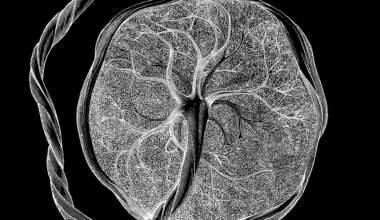 illustration shows a black and white depiction of the fetal side of the placenta