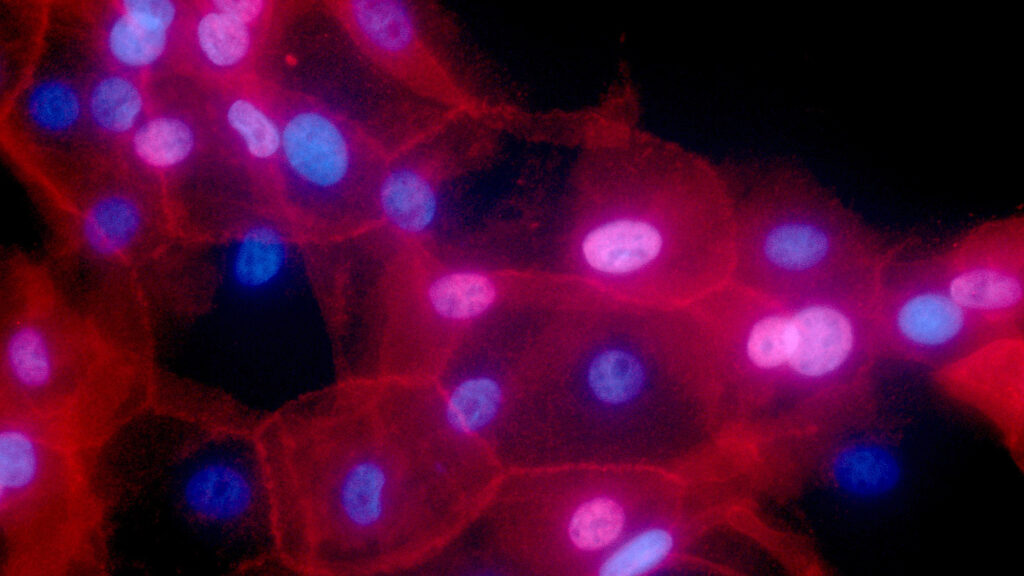 Study finds missed opportunities for targeted cancer treatments