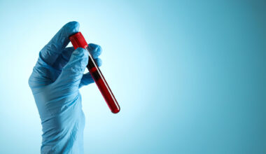 Blood in test tube.