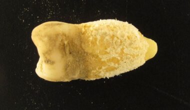 A Bolivian Mummy's Tooth Is Rewriting The History of Scarlet Fever : ScienceAlert