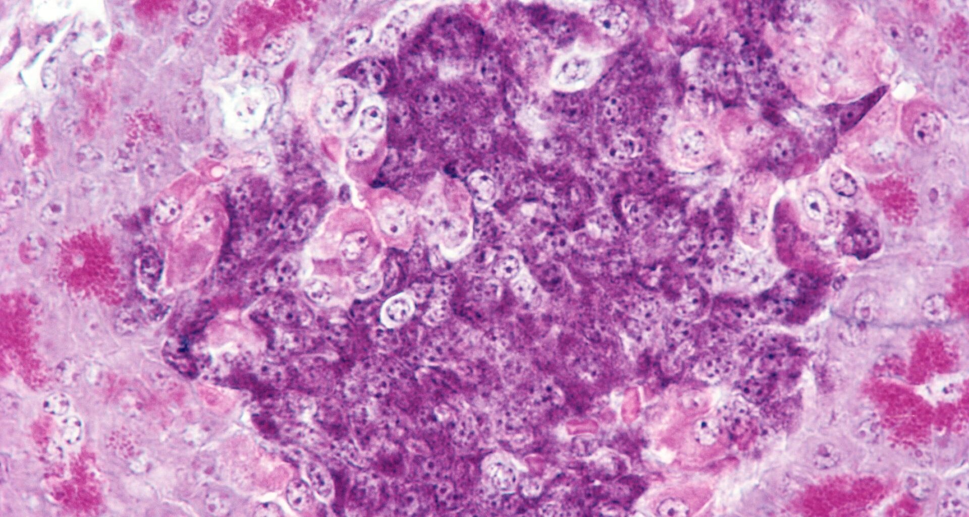 A close up of the pancreas, where purple and pink stained cells can be seen with dark dots for their nucleii