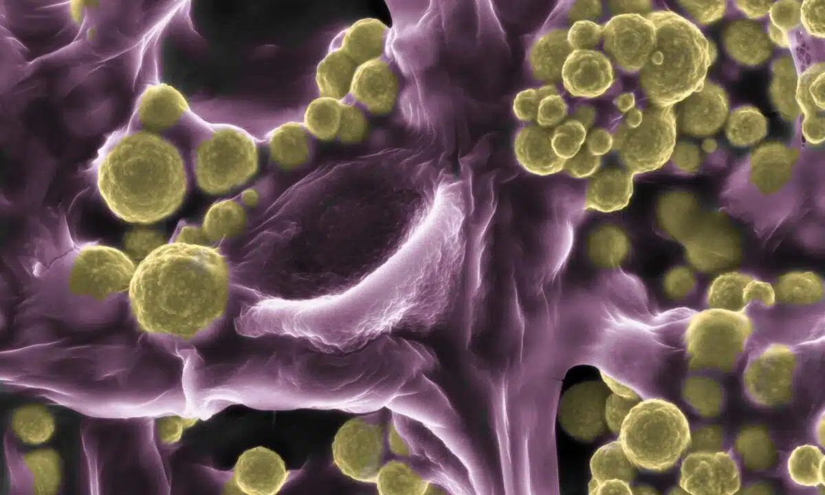 Fungi That Draws Gold From Its Surroundings That Has Been Discovered In Western Australia