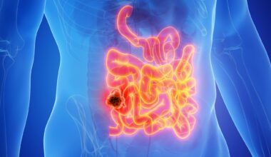 Male Anatomy Cancer Small Intestine