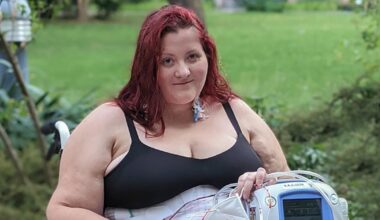 Shocking photo reveals giant 'unfixable' hernia in woman's stomach