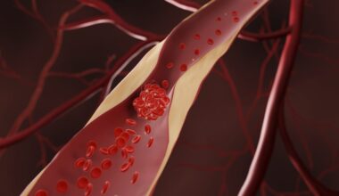If you have high cholesterol, there are alternatives to statins