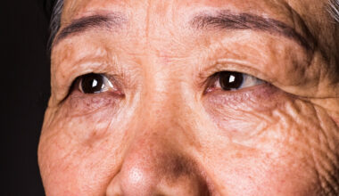Your Vision Can Predict Dementia 12 Years Before a Diagnosis, Study Suggests : ScienceAlert