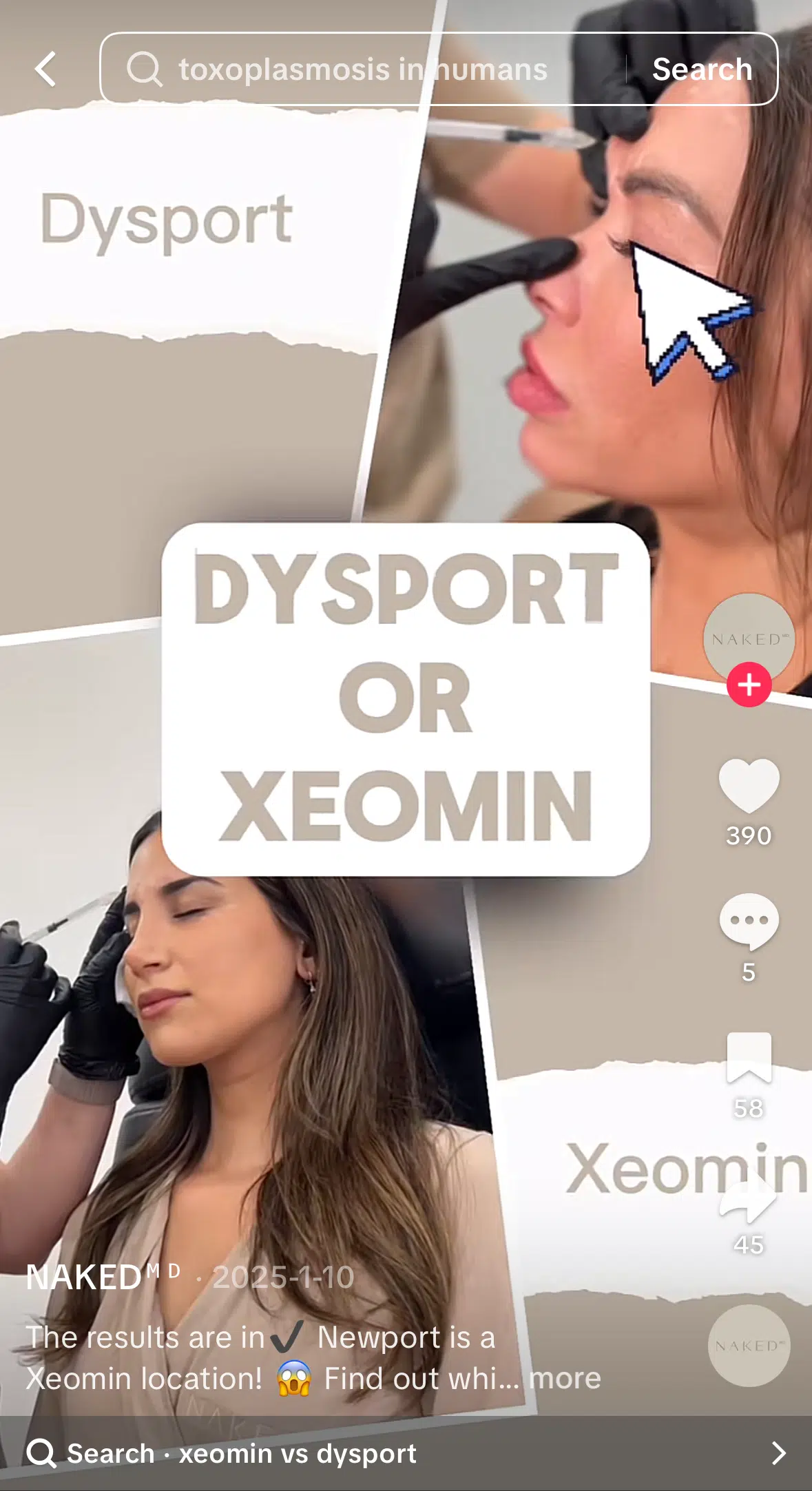 Toxoplasmosis In Humans Scaled