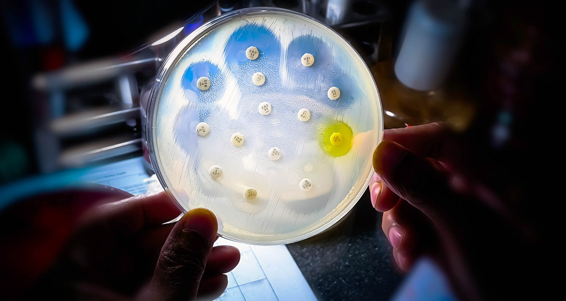 Common infections are no longer responding to antibiotics