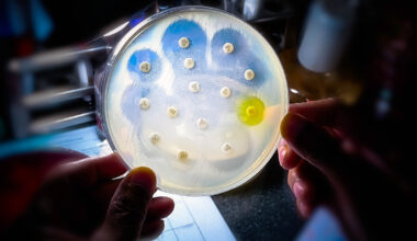 Common infections are no longer responding to antibiotics