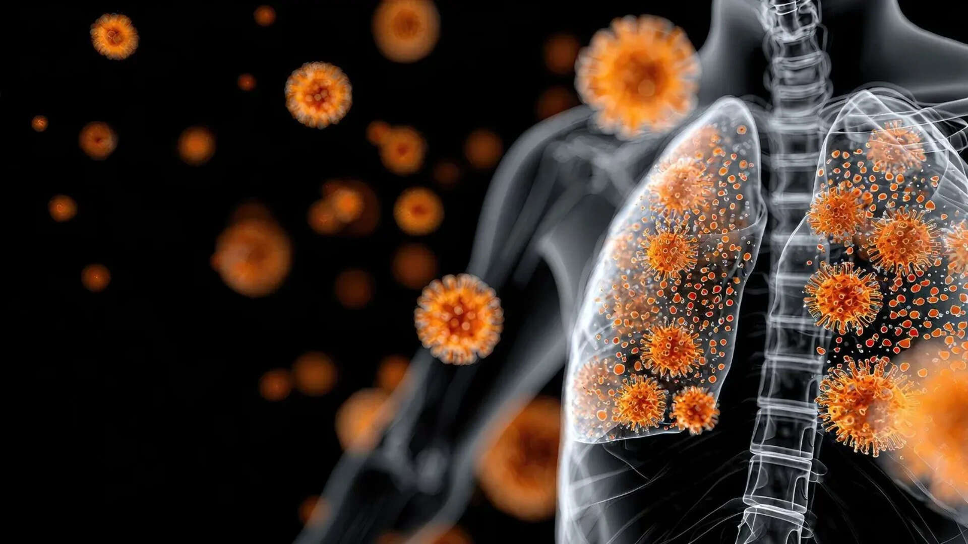 autoimmune disease