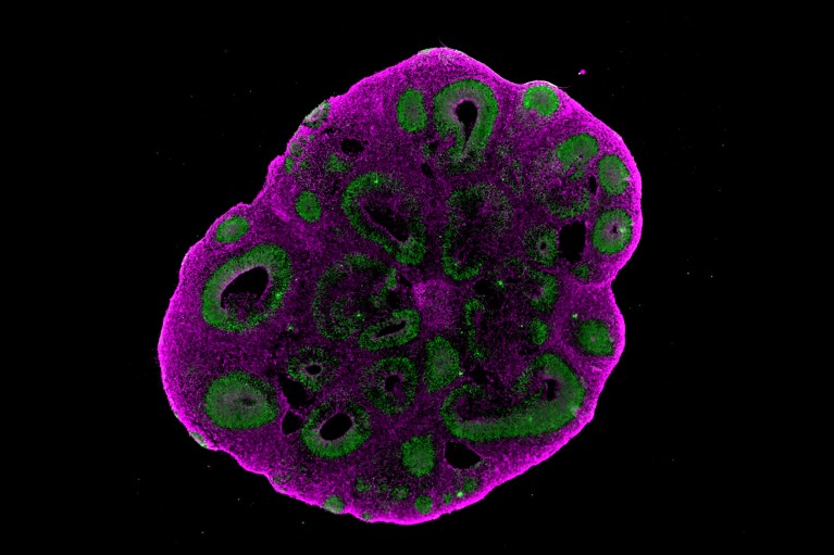 A microscopy image of a circular organoid with bright purple outer tissue and green structures forming clustered rings inside on a black background
