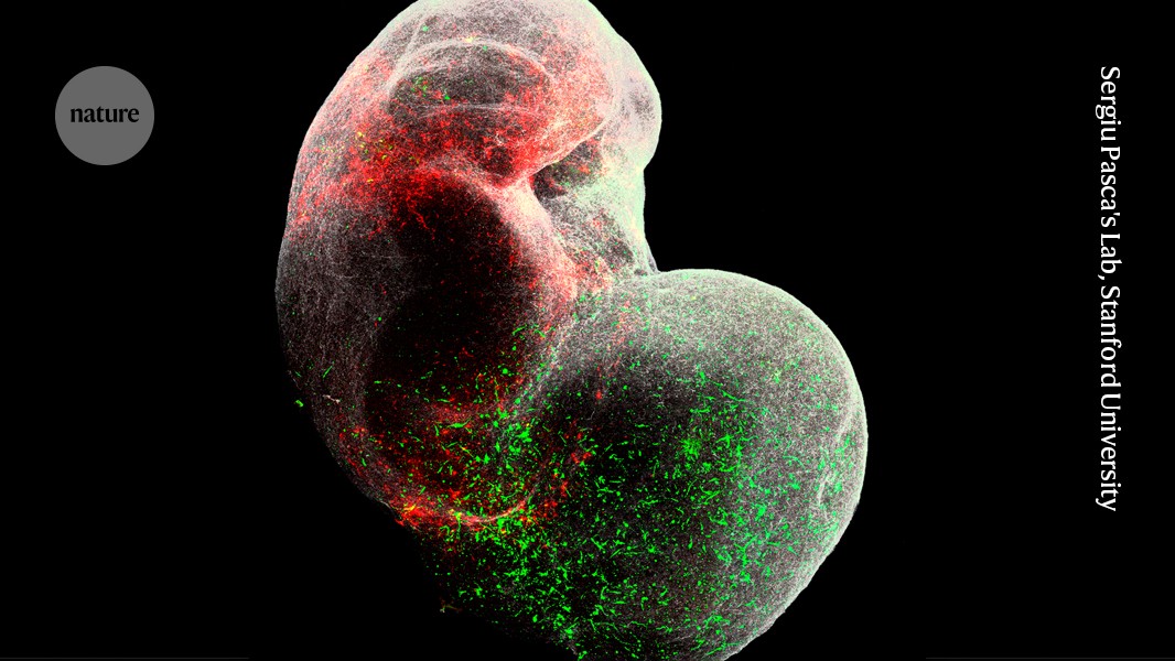 Mini models of the human brain are revealing how this complex organ takes shape