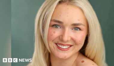 Helen Stroud is wearing a sports crop top showing her back, which has a slightly darker tone to it, showing the light scarring of surgeries. She has her blonde hair loosely tied back and is smiling as she turns her head to the right. She is standing in a garden with grass in the background and a fence.